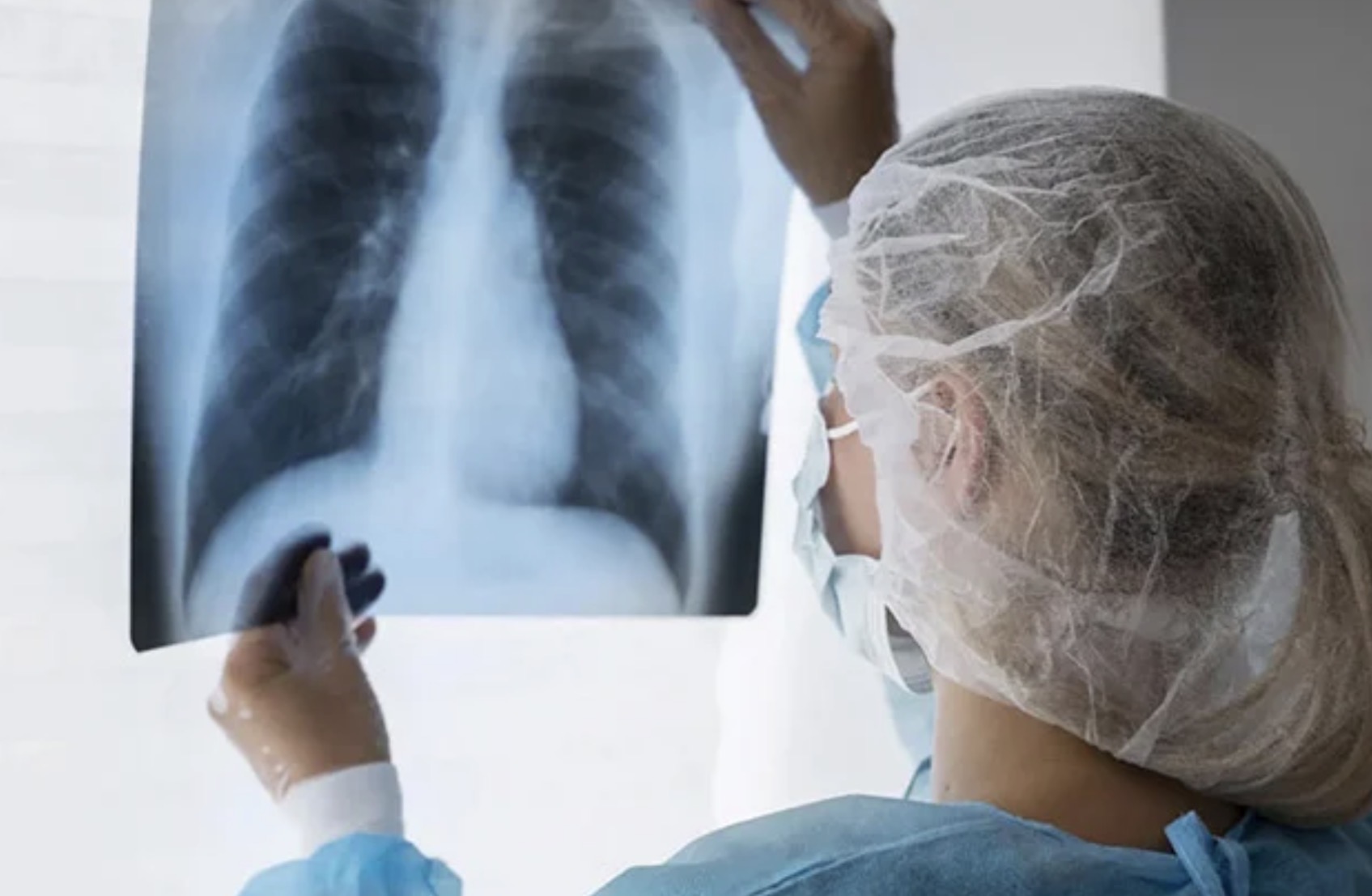 Salud actualiza las pautas para el abordaje de la tuberculosis en todo el país