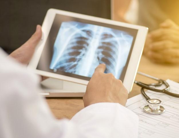 Preocupa avance de la tuberculosis: en Entre Ríos aumentaron un 38,8% los casos